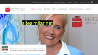 implantatcenter.dk alternative sites
