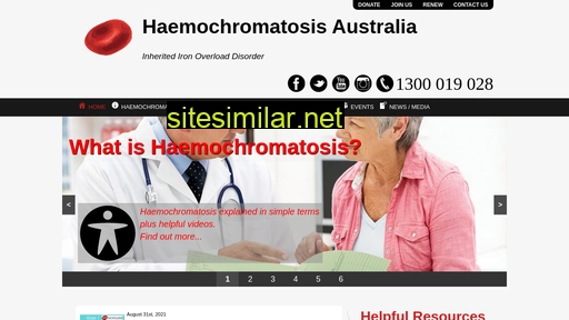Haemochromatosis similar sites