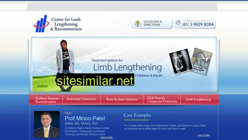 limblengthening.com.au alternative sites