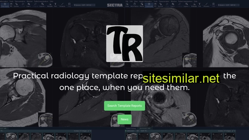 radiologytemplates.com.au alternative sites