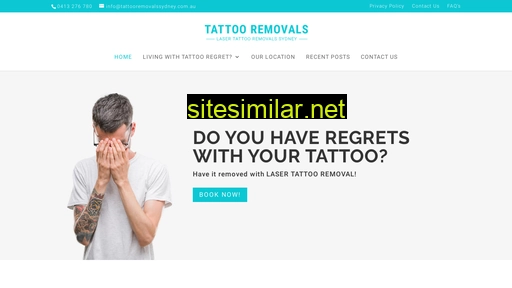 tattooremovalssydney.com.au alternative sites