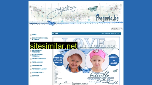 progeria.be alternative sites