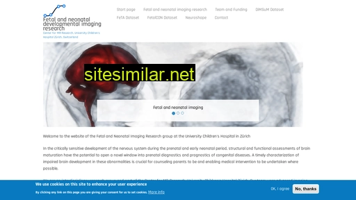 neuroimaging.ch alternative sites