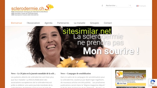 sclerodermie.ch alternative sites