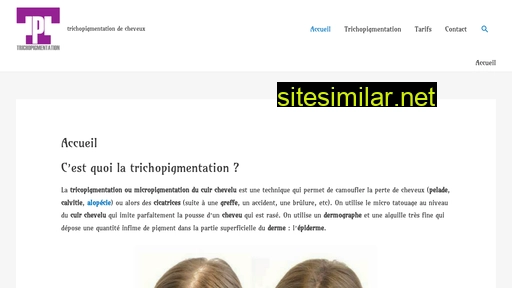 Trichopigmentation similar sites