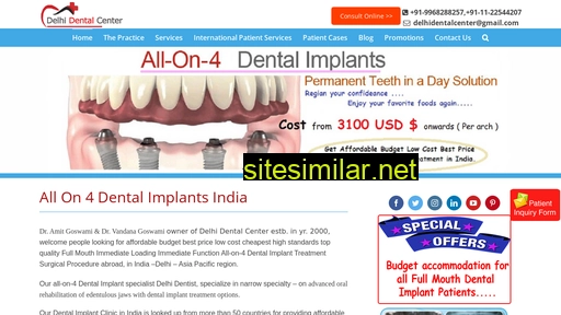all-on-4-dentalimplantsindia.com alternative sites