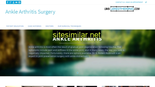 anklearthritis.com alternative sites