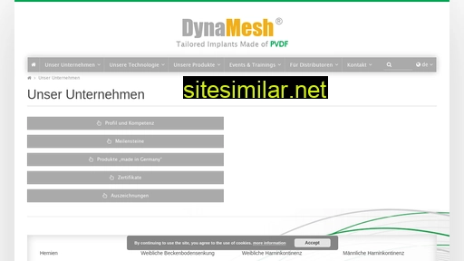 de.dyna-mesh.com alternative sites
