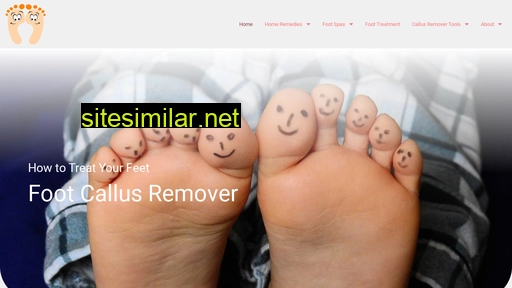 footcallusremover.com alternative sites
