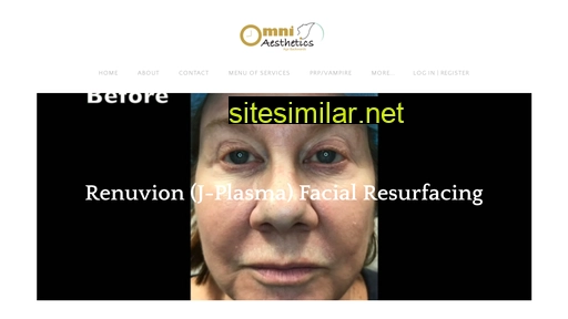 jplasmafacelift.com alternative sites
