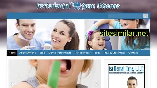 Periodontal-gum-disease similar sites