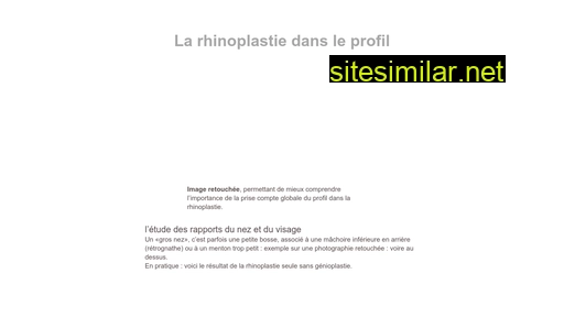 rhinoplastie-esthetique-paris.com alternative sites