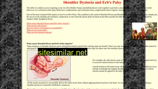Shoulderdystociaattorney similar sites