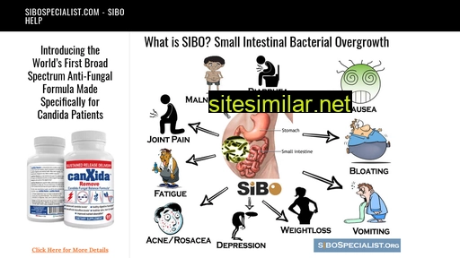 sibospecialist.com alternative sites