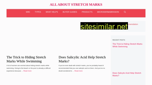 stretchmarkremovalinfo.com alternative sites