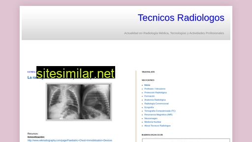 tecnicosradiologia.com alternative sites