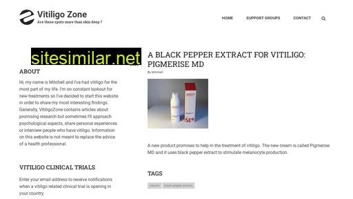vitiligozone.com alternative sites