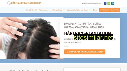 hårtransplantation.com alternative sites