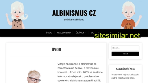 albinismus.cz alternative sites