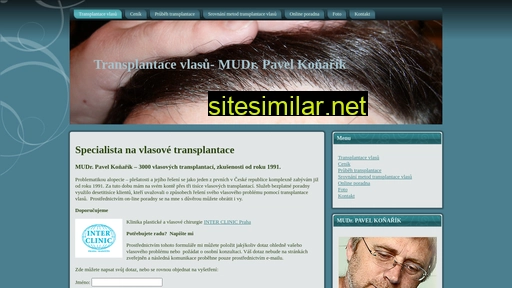 transplantace-vlasu.cz alternative sites
