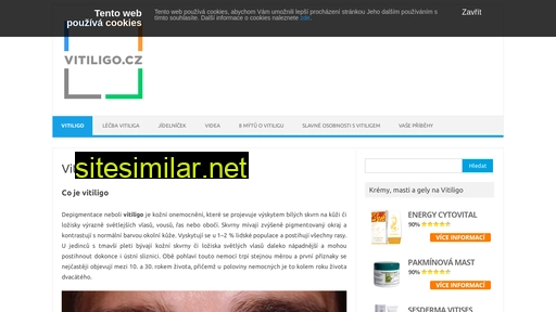 vitiligo.cz alternative sites