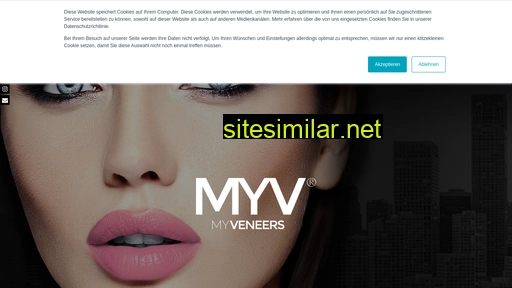myveneers.de alternative sites