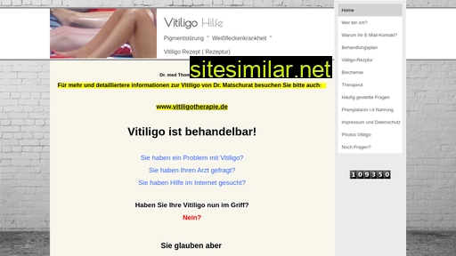rezeptur-bei-vitiligo.de alternative sites