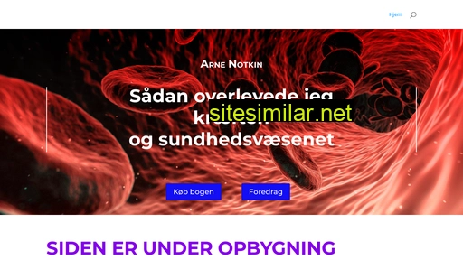 notkin.dk alternative sites