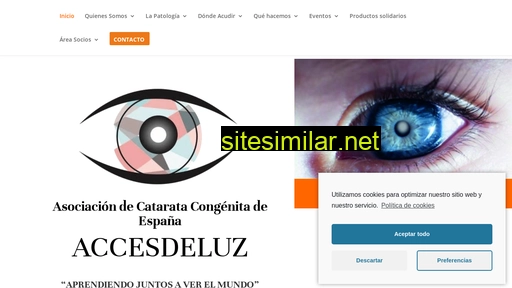 cataratacongenita.es alternative sites