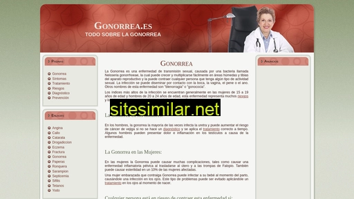 gonorrea.es alternative sites