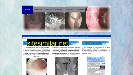 histeroscopia.es alternative sites
