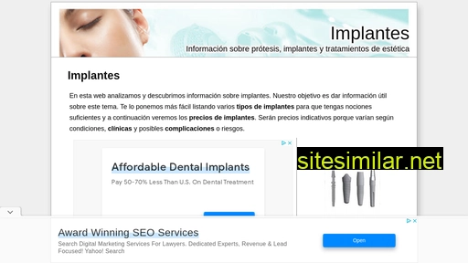 Implante similar sites