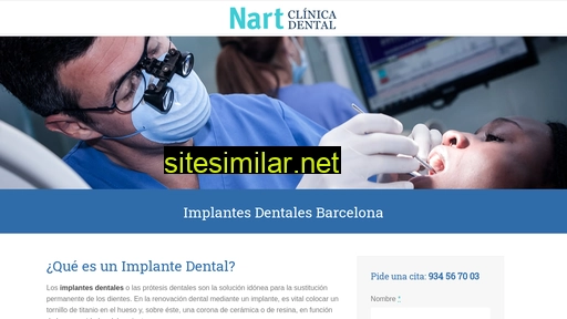 implantesdentalesbarcelona.es alternative sites