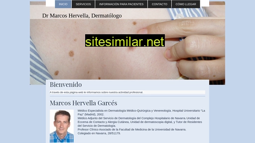 marcoshervella.es alternative sites