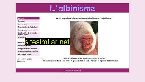 albinisme.free.fr alternative sites