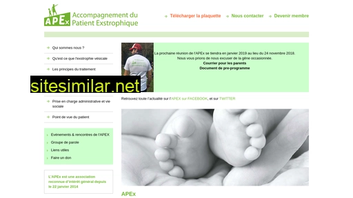 exstrophie-apex.fr alternative sites