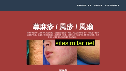 urticaria.com.hk alternative sites