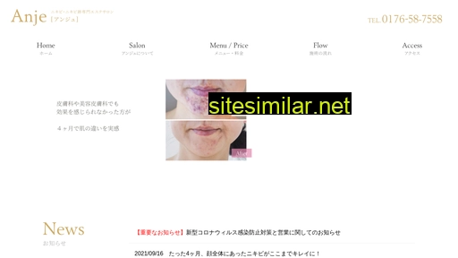 anje.jp alternative sites