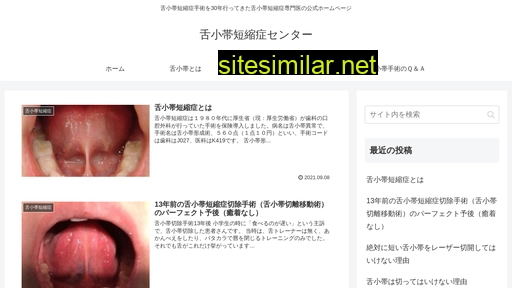 tongue-tie.jp alternative sites