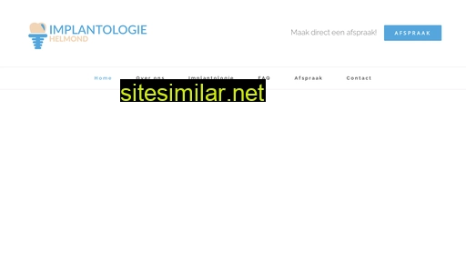 implantolooghelmond.nl alternative sites