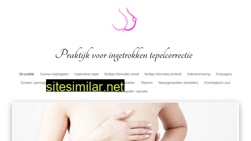 ingetrokkentepelcorrectie.nl alternative sites
