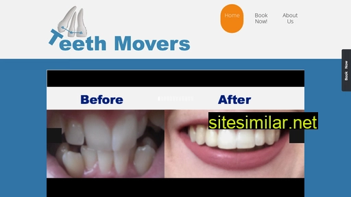teethmovers.co.nz alternative sites
