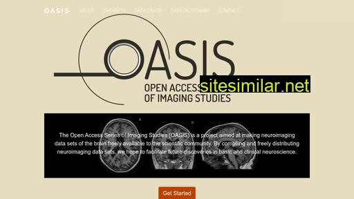 oasis-brains.org alternative sites