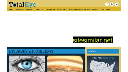 totaleye.org alternative sites