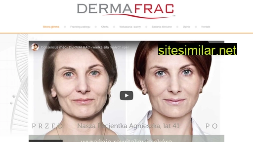 dermafrac.pl alternative sites