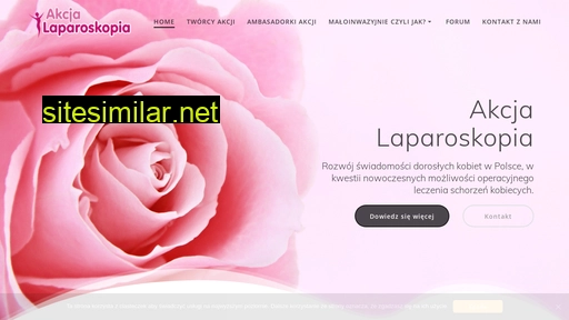laparoskopia.pl alternative sites