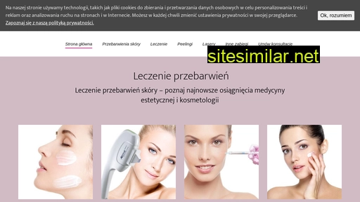 leczenieprzebarwien.pl alternative sites