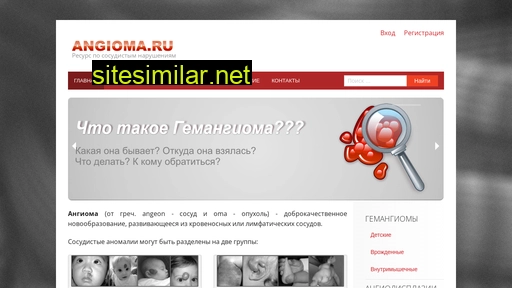 angioma.ru alternative sites