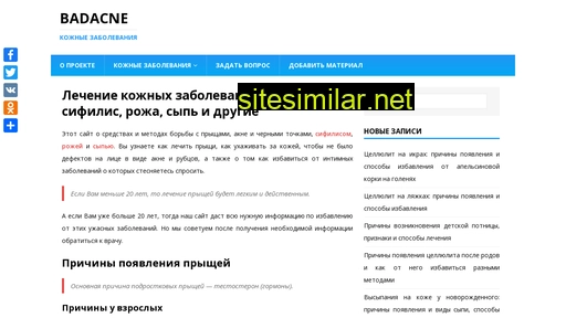 badacne.ru alternative sites