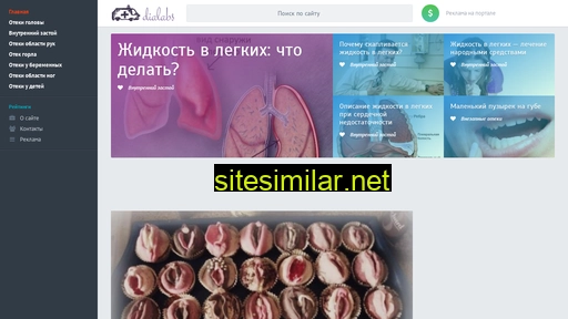 dialabs.ru alternative sites